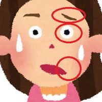 🥴顔面神経麻痺🥴を考える
