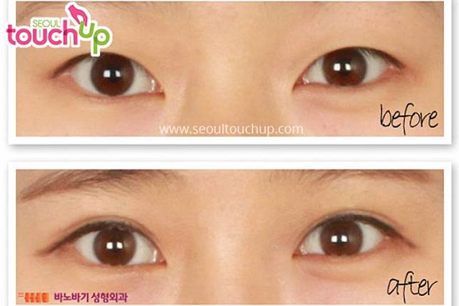 Seoul Touch Up