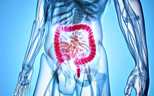 不看會後悔！結腸與大腸直腸癌的關係