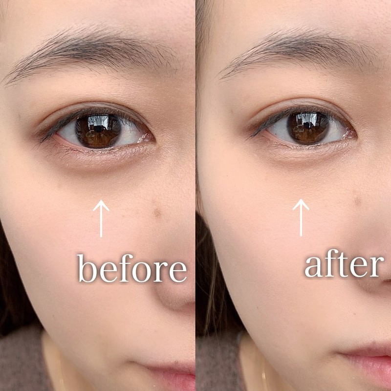 クマの隠し方 が タイプ別にわかる コンシーラーの選び方や赤リップで隠す方法も Mine