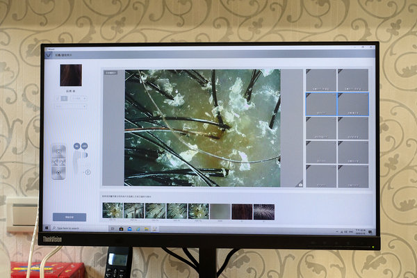 台北頭皮護理，台北頭皮養護spa-WT Methode美絲得，源自韓國的台北專業頭皮養護，給頭皮極致享受的大直頭皮護理中心