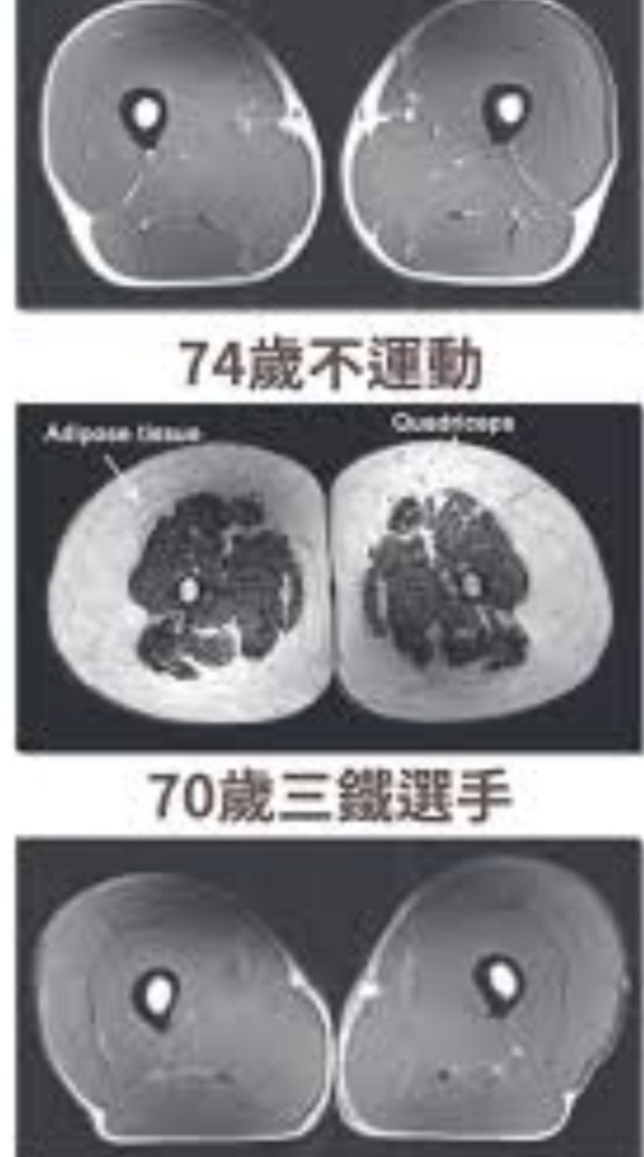 彈力繩運動練肌力（高齡者、銀髮族、高年級生、壯世代）