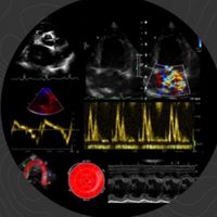 Echocardiography Learning Lab