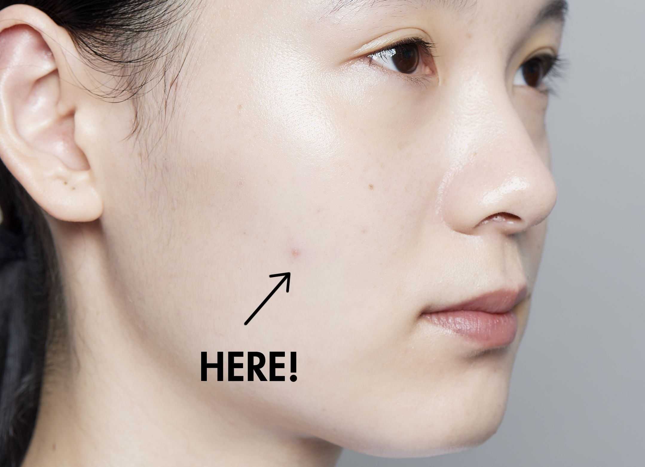 ニキビ跡はこう消す 赤みをカバーするメイク方法