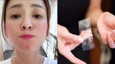 很多人都不正確使用暗瘡貼！暗瘡貼正確用法＋暗瘡位置毛病大公開