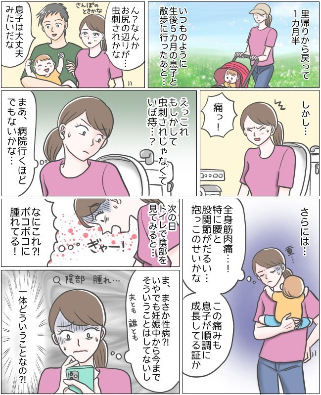 え ボコボコに腫れている 産後ママを襲う激痛 意外な感染症とは ベビーカレンダー