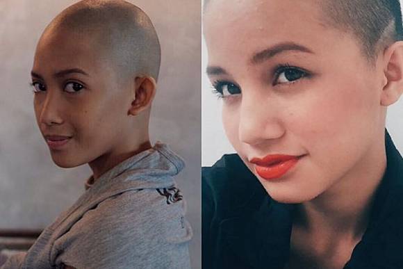 Berani Beda 5 Artis Ini Tampil Gundul Demi Totalitas Peran