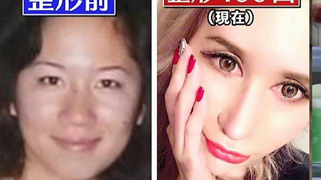 20年來，田崎整形超過100回，花費逾3500萬。圖／翻攝自ネットもテレ東　推特