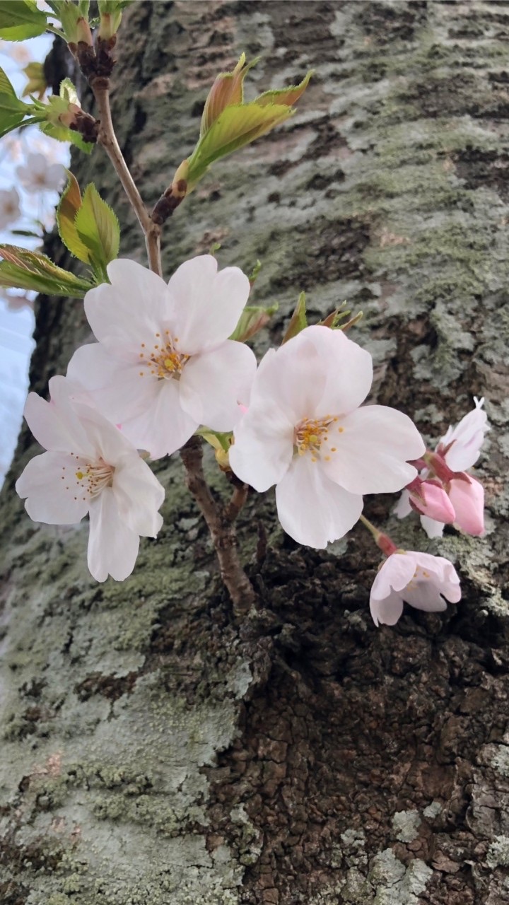 子宮筋腫・卵巣嚢腫…手術検討の方