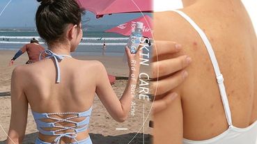 【膿痘剋星】5款PTT、Dcard網友熱議「對抗背痘」神物推薦！改善粉刺、痘痘、雞皮超有感，讓肌膚好似開柔焦濾鏡！