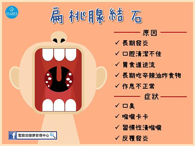 嘴超臭 耳朵痛 你扁桃腺可能結石啦 三立新聞網 Line Today