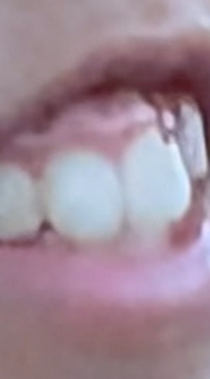 森林中的99夜攻略群