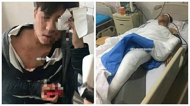 瀋陽1名男碩士生日前因為和2名女同學為了獎學金歸屬起了爭執，結果遭對方找人斷腳筋。(圖／翻攝自微博)