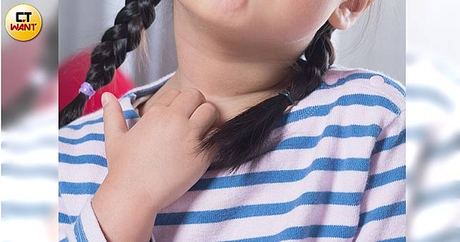 難纏蕁麻疹　減敏療法改善7成