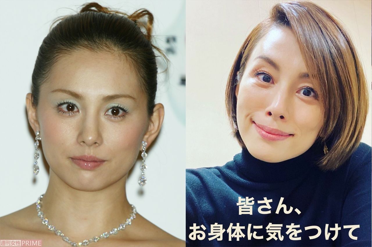 米倉涼子 藤原紀香 長谷川理恵 梨花の顔面変化を美容外科医が分析