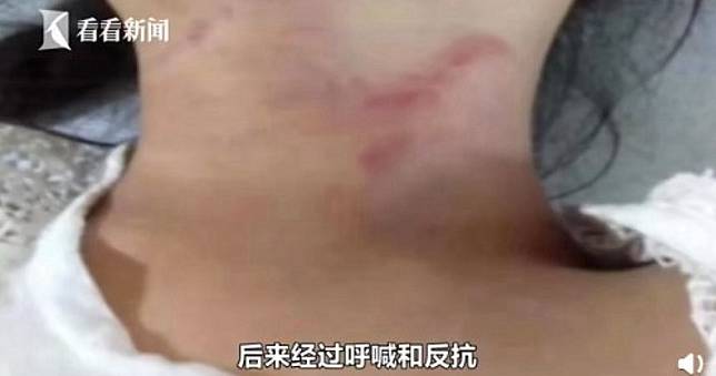 午睡被女童嬉鬧聲吵醒！男強拽她進屋猛掐　水果刀狠刺臀