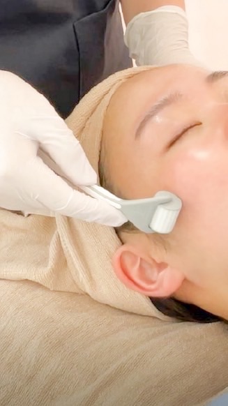 ダーマローラーコミュニティ