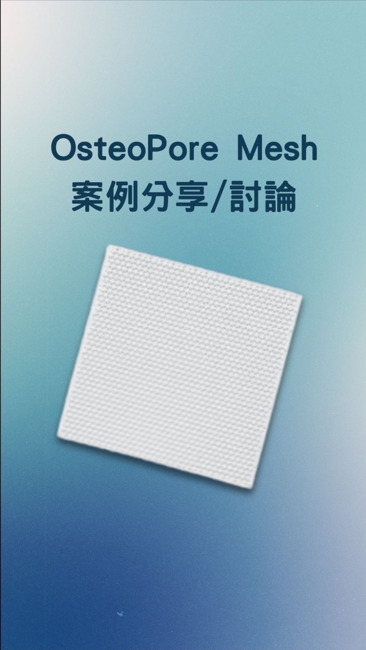 OsteoMesh案例分享/討論群