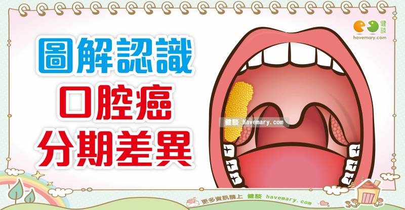 口腔癌的分期 健談網 Line Today