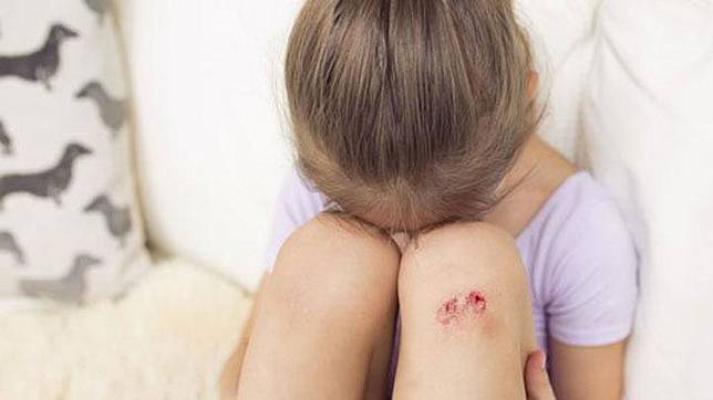 Peneliti Ungkap Khasiat Air Liur Untuk Sembuhkan Luka