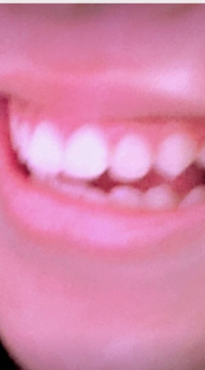 โอเพนแชทที่ไม่รู้จัก