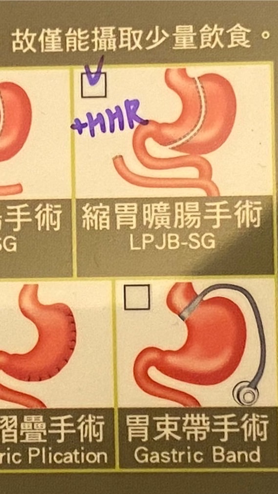 縮胃/胃繞道/縮胃曠腸/sasi/二分/胃縫/飲食控制/減肥/減重/生活飲食分享/皆可聊小鳥胃聊天室