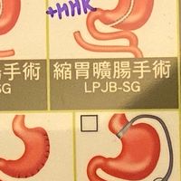 減重手術皆能聊的聊天室/縮胃/胃繞道/縮胃曠腸/sasi/胃縫/飲食控制/減肥/減重/飲控生活分享