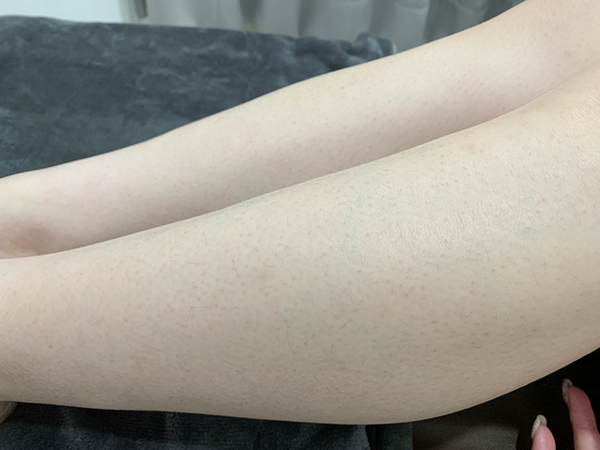 倪倪愛漂亮－『台中除毛推薦』女星名媛網紅安全可靠私密處VIO除毛與腳部除毛秘密基地-媄婧美學診所德國二極體光纖雷射與無痛真空除毛療程直擊分享，台中雷射除毛價格，除毛推薦，台中雷射除毛