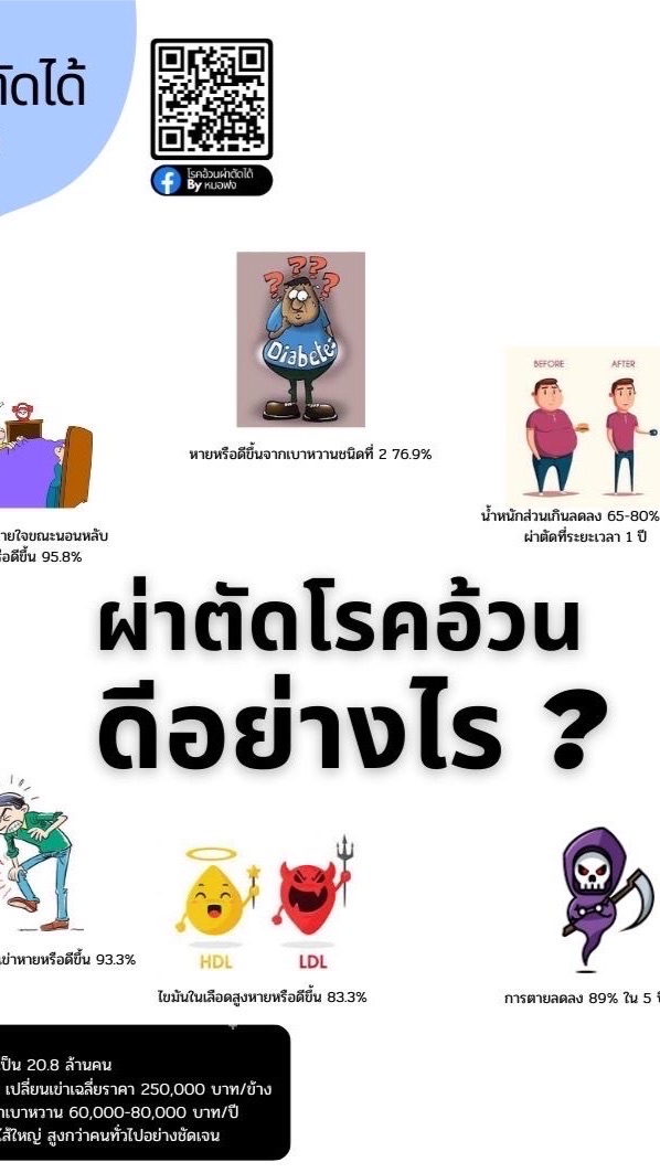 โรคอ้วนผ่าตัดได้หมอฟง