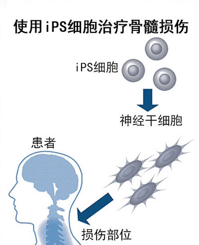 再生醫療大進展日本批准ips細胞治療脊髓損傷 中廣新聞網 Line Today