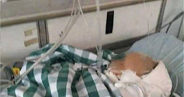 天外飛砸一塊磚　1歲男嬰頭骨凹陷被宣告腦死