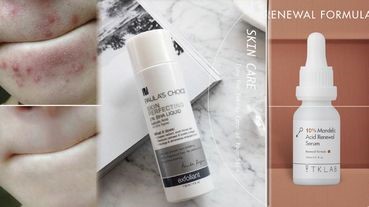 油痘肌必看，5個好習慣告別痘花臉！加碼網友好評抗痘精華推薦，幫你早日擺脫爆痘、粉刺林