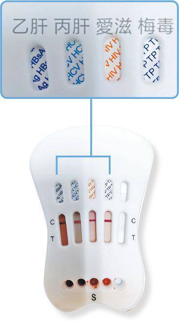 社工轉職性治療師用交友app輔導 明報 Line Today