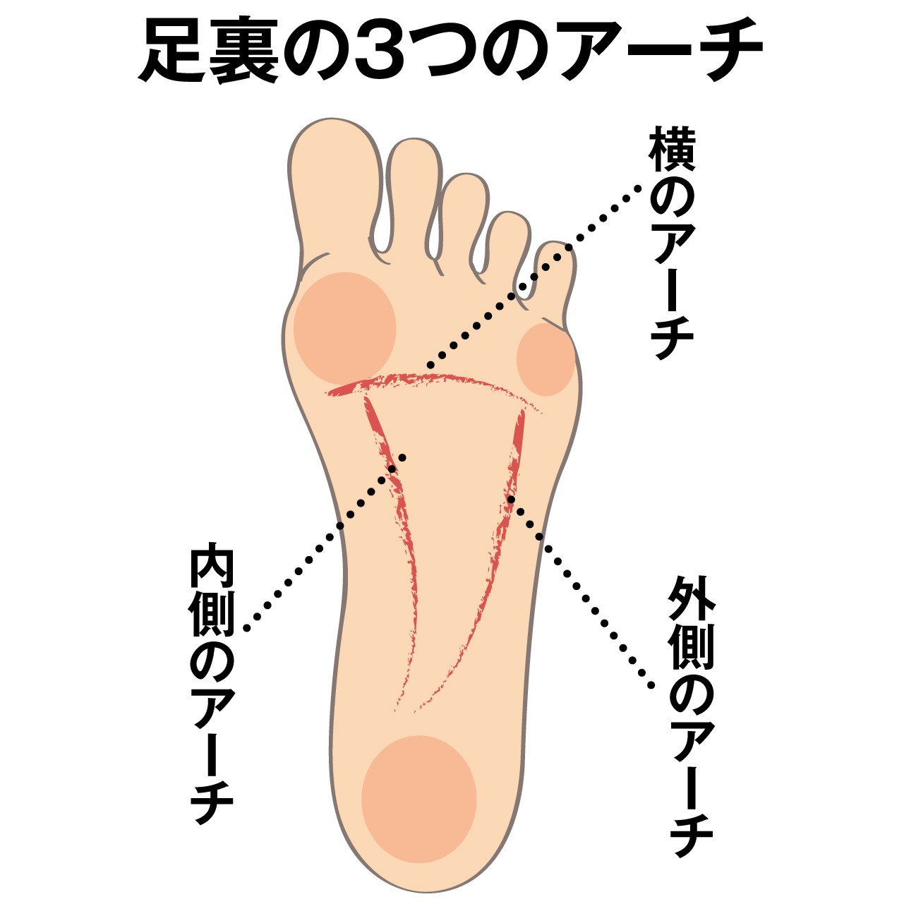 足裏にタコ 外反母趾になっている 人 歩き方の問題は 脚や歩行のトラブル原因と対策