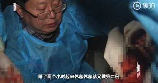 新冠肺炎過世患者病理解剖　專家：「肺部塞滿黏液」不同於SARS