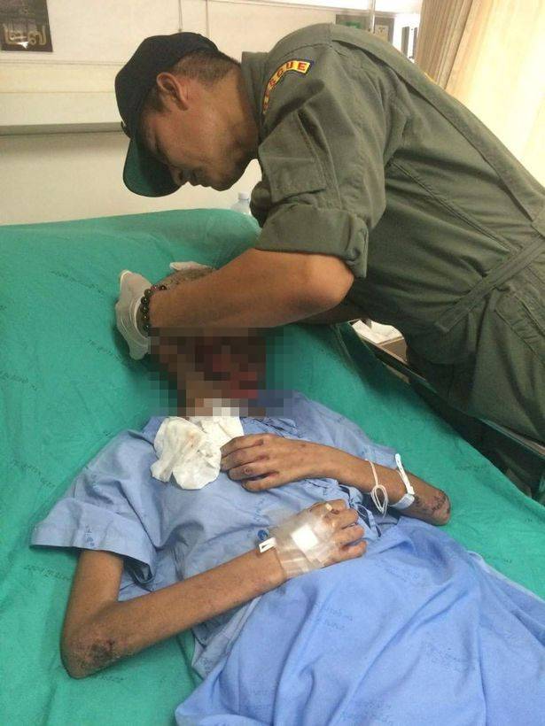 Awalnya Sariawan, Kulit Wajah & Tubuh Gadis Ini Malah Jadi Mengerikan
