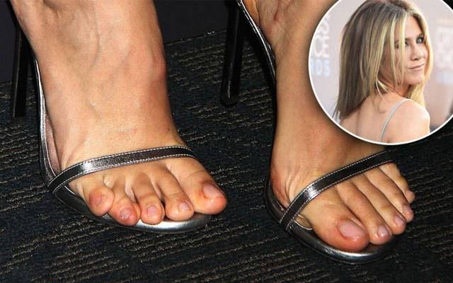 Iyuh, Kaki 13 Seleb Dunia Ini Nggak Semulus Wajahnya, Nomor 7 Paling Bikin Ilfeel!