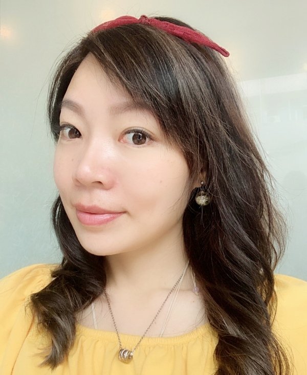 倪倪愛漂亮－『醫美推薦』女星名媛網紅煥然一新蘋果肌玻尿酸預約制安全可靠隱密性高聖地-台中市米秝琪整形外科診所直擊分享