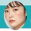 シミ治療相談室〈美容医療〉