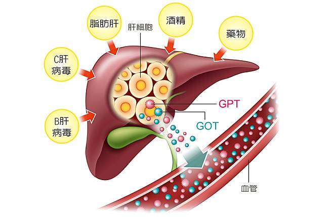 自己 免疫 性 肝炎