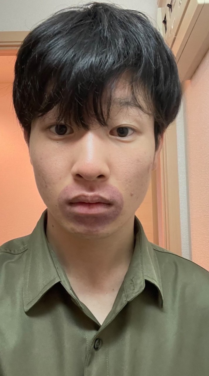 OpenChat 佐藤ヒロキ(ハルドルジョア)愛好会[非公認]