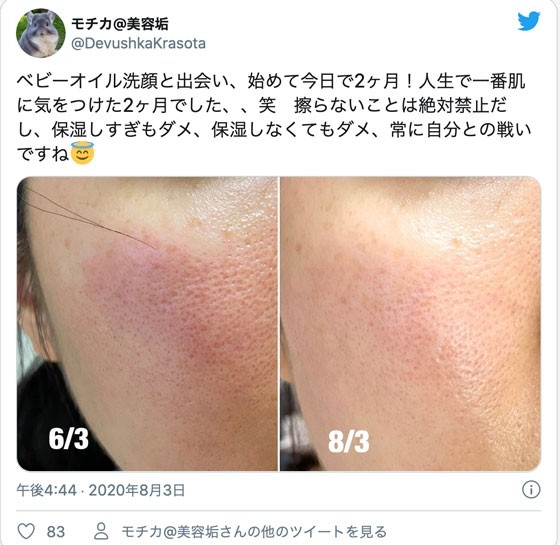 Twitterで話題沸騰 美容愛好家mimiさん発 肌に奇跡を起こす ベビーオイル洗顔 とは