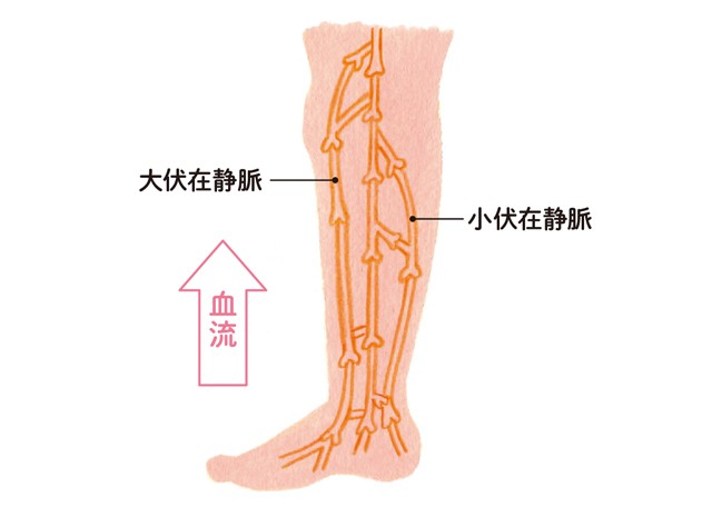 睡眠中 こむらがえり が起きる人は注意して 下肢静脈瘤 5つの症状