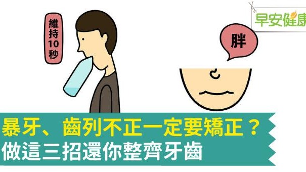 牙齒矯正前該知道的事！齒列不正一定要矯正牙齒嗎？