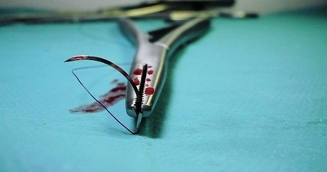 人妻摘完子宮才2周…老公「偷開機」　醫驚見私密處掉出「一條軟軟的」