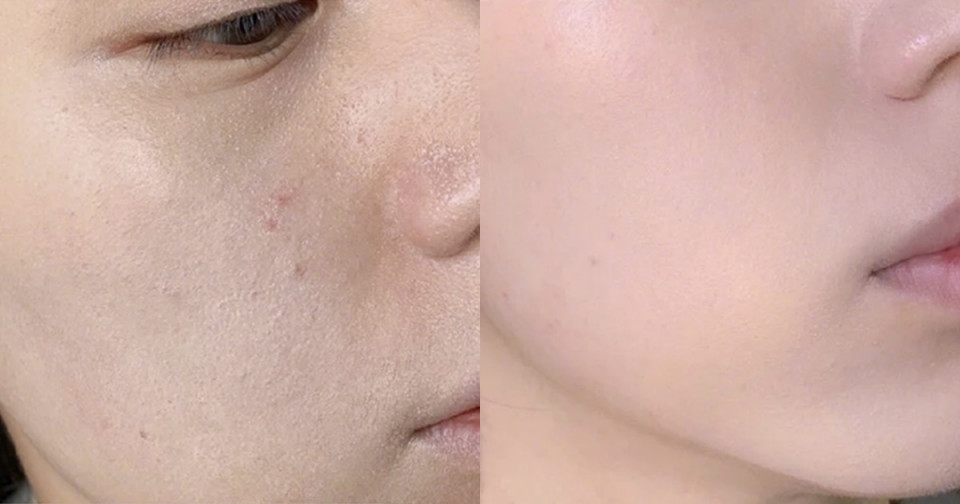 肌膚不穩定上妝TIPS 1：上妝前噴化妝水／濕海綿吸油