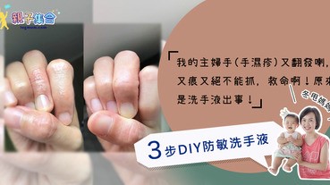 【專欄作家：冬甩媽媽】我的主婦手（手濕疹）又痕又絕不能抓，救命啊！3步DIY防敏洗手液