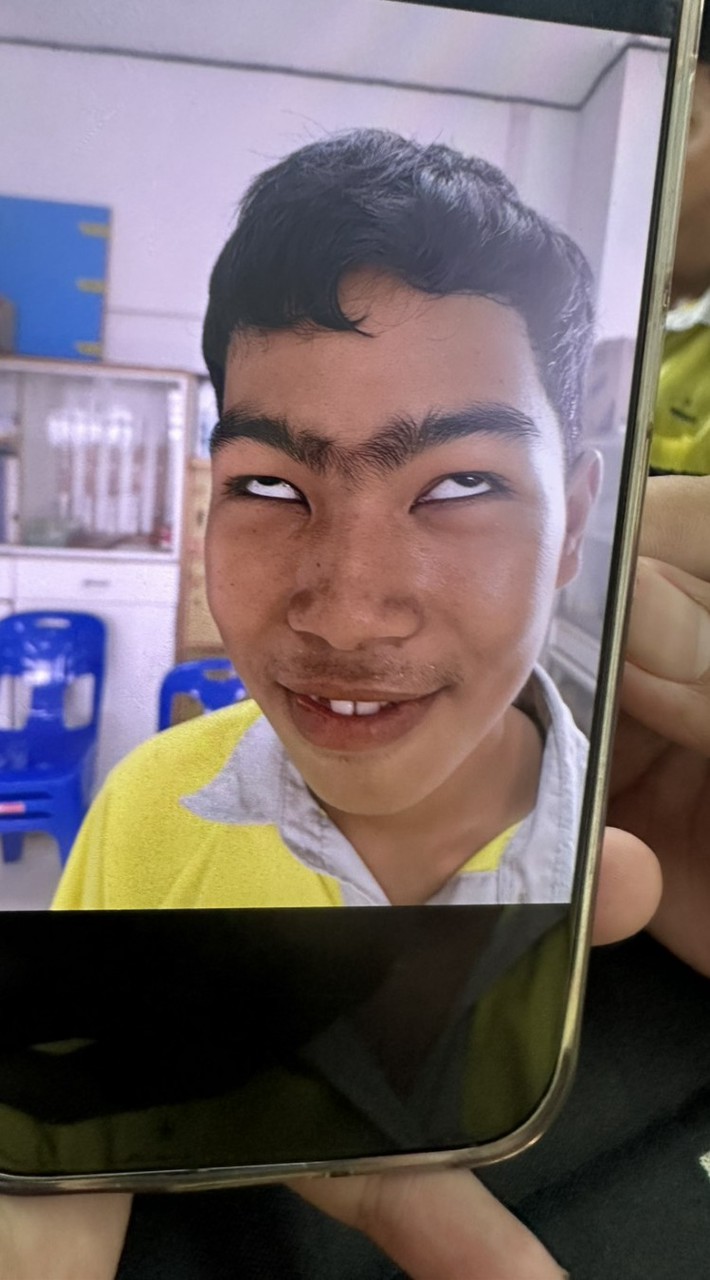 รด 69
