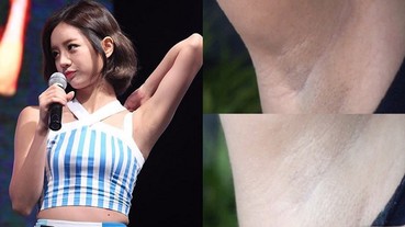 「腋下黑漆漆」不敢舉起手？超簡單 1 招還你嫩白胳肢窩！