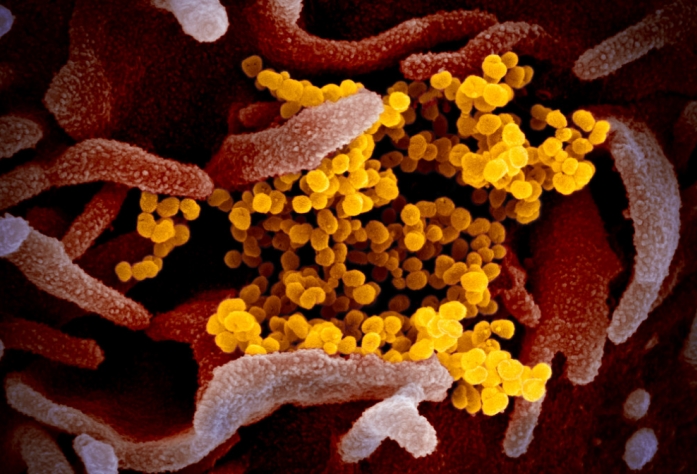 武漢肺炎病毒到底長什麼樣子？這就是惡名昭彰的「COVID-19」真面目